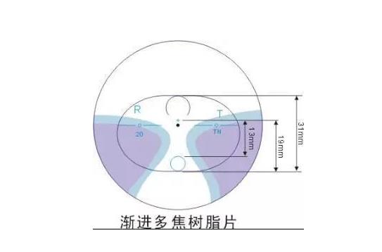 美麗島漸進(jìn)多焦鏡適合的人群，需要注意的事項